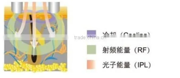 Permanent hair removal painless protable ipl skin treatment system