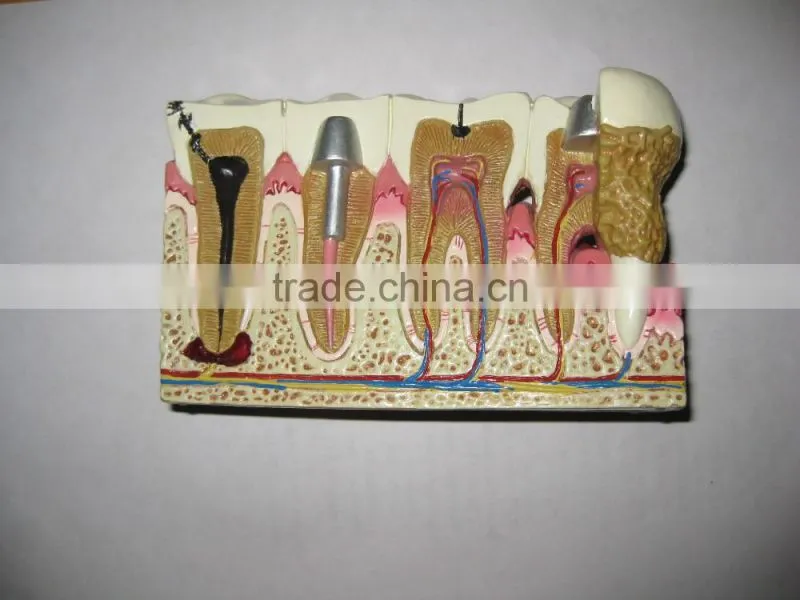 OEM anatomical cardiopulmonary model/anatomical model/teeth model/eyes model/plastic organ model