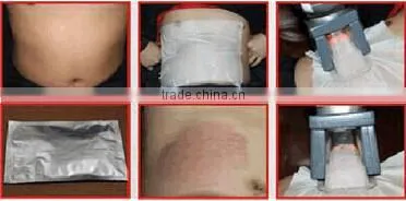cryolipolysis fat reducing machine/cryolipolysis fat removal machine/ cryolipolysis machine