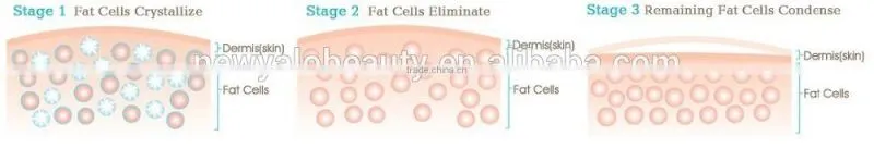 Most popular products cryo and laser weight loss slimming machine for CE Certificate