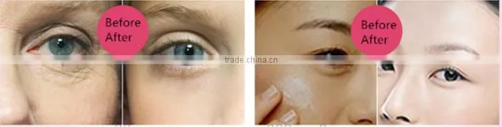 nano facial mist sprayer facial steamer sell beauty products online in stock for sale