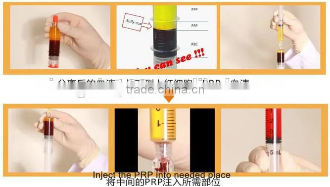 Prp Centrifuge Machine Price for TD4-ZF