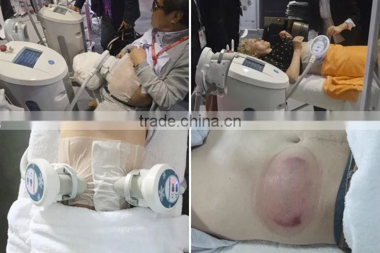 Body shaping machine/ cool slimming machine/ cool tech fat freezing machine