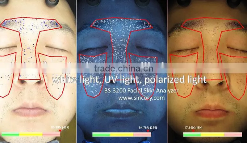 Wood Lamp Scanner Machine For Facial Skin Analysis