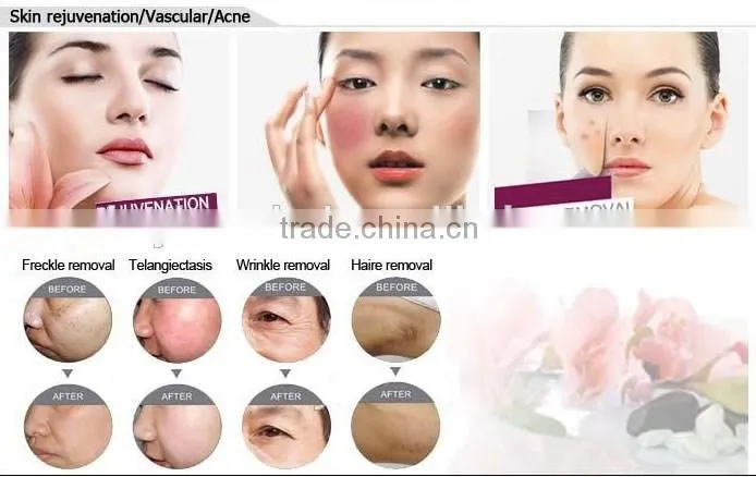 latest beauty equipmentipl shr laser hair removal machines shr ipl hair removal for sale with two handles