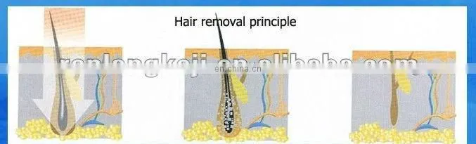 Spa use!!! portable ipl elight machine for men permanent hair removal