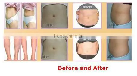 Full body shaping ultrasonic liposuction cavitation equipment