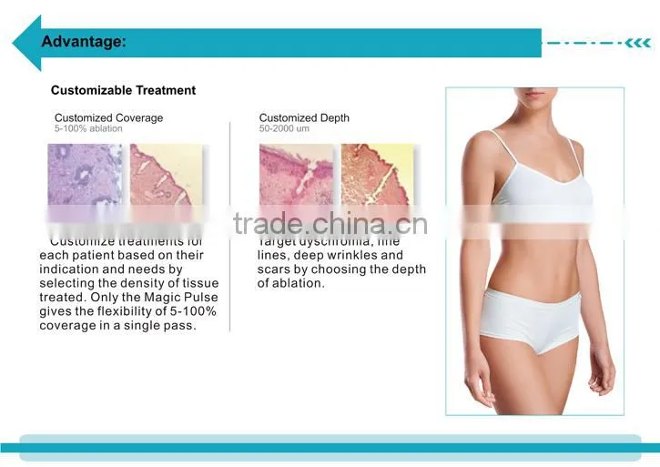 Portable CO2 Laser Fractional Pixel Vaginal Laser Tightening