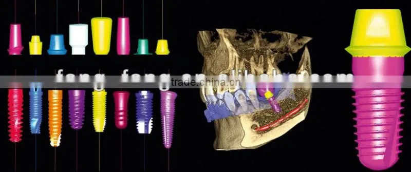Digital 3D Intra-oral imaging X-ray machine