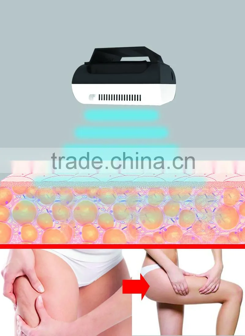 Mini Vacuum Cryo Fat Reduction Beauty Slimming Equipment