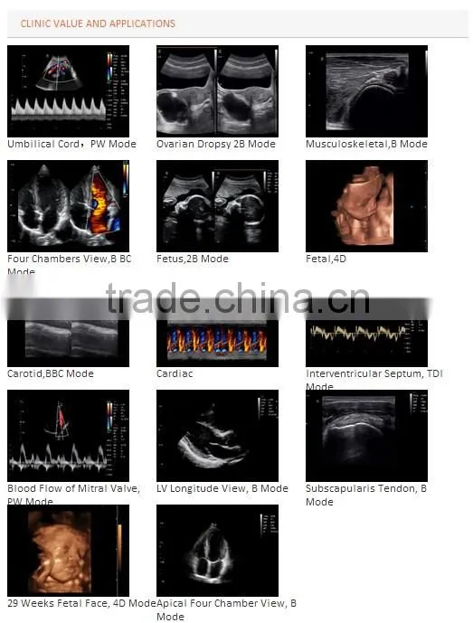 CE approved Trolley Color Ultrasound Scanner with Optional 4D function( i8)