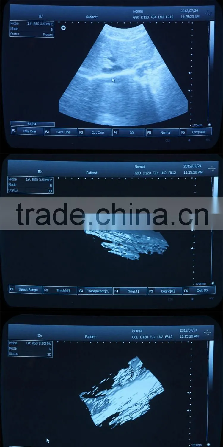 3D Portable Veterinary ultrasound machine