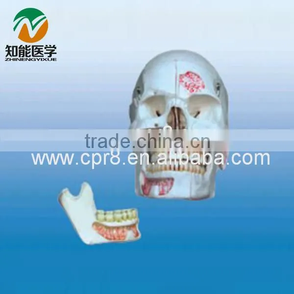 The skull (10 parts) BIX - L1013