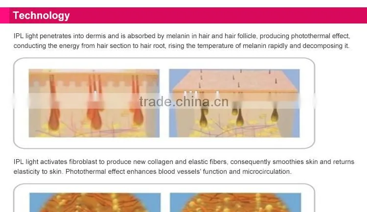 2015 Professional IPL Technology hair removal equipment for home use