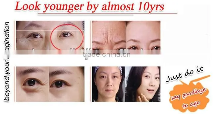 At home skin tightening machine(HM-RF-A100)