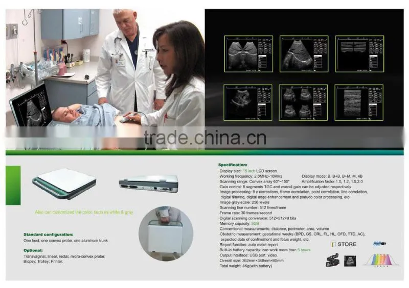 MSLPU25A HOT SALES Digital best Medical portable china portable ultrasound machine price