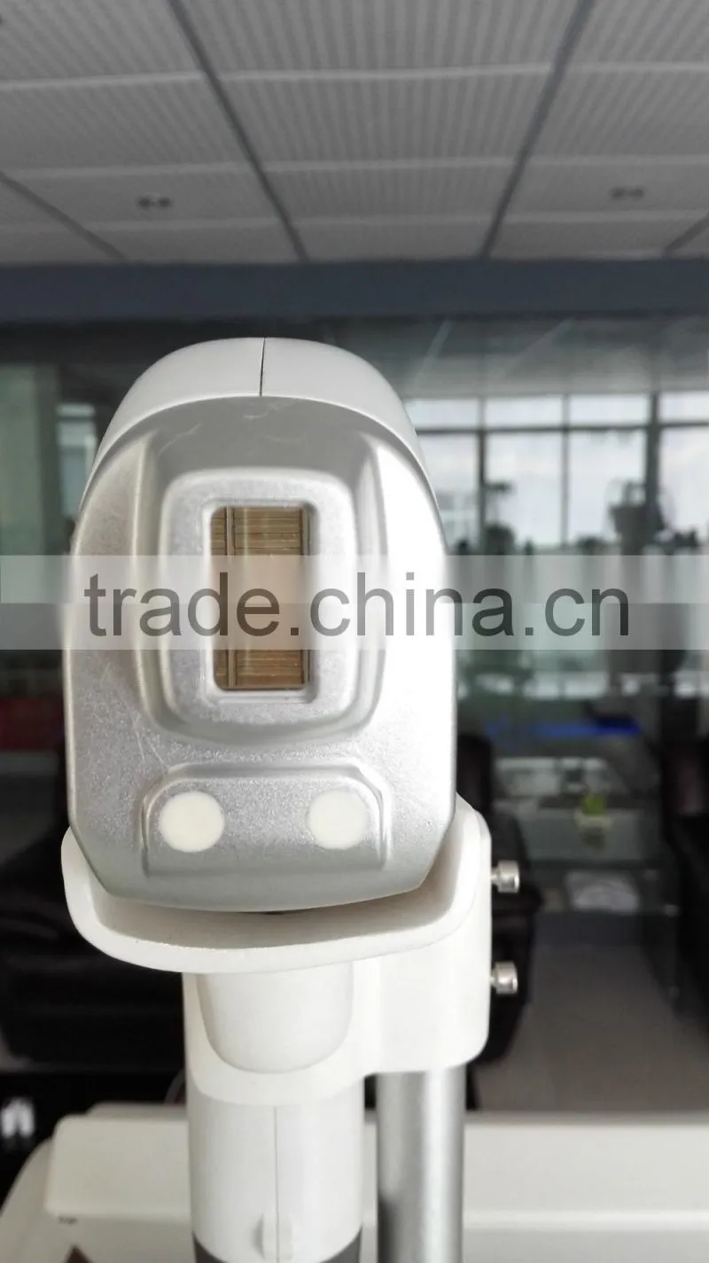 808nm diode laser / diode laser hair removal / permanent hair removal
