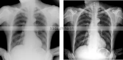 Dynamic UC-ARM DR