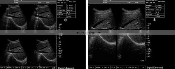 Portable Ultrasonic Diagnostic Devices , Laptop Portable Ultrasound Machine & Ultrasound Scanner