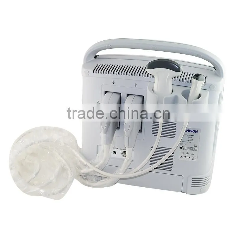 2015 hot selling Veterinary Instrument Ultrasound Scanner ECO1 VET with 2.5-11MHz probe frequency