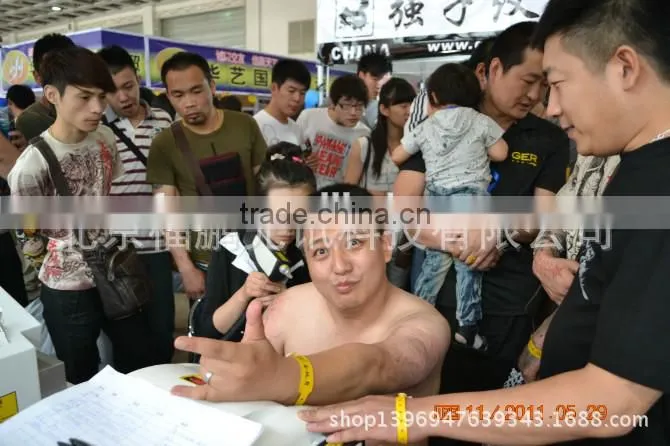 ipl rf equipment/laser tattoo removal machine