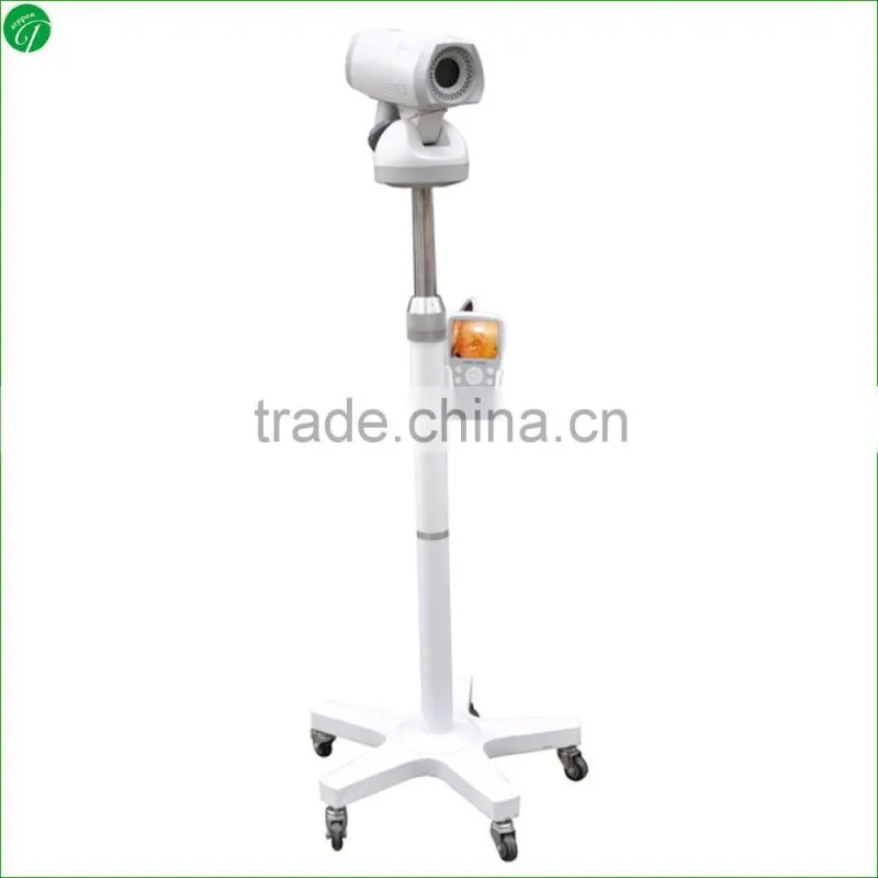 video colposcope supplier colposcope prices