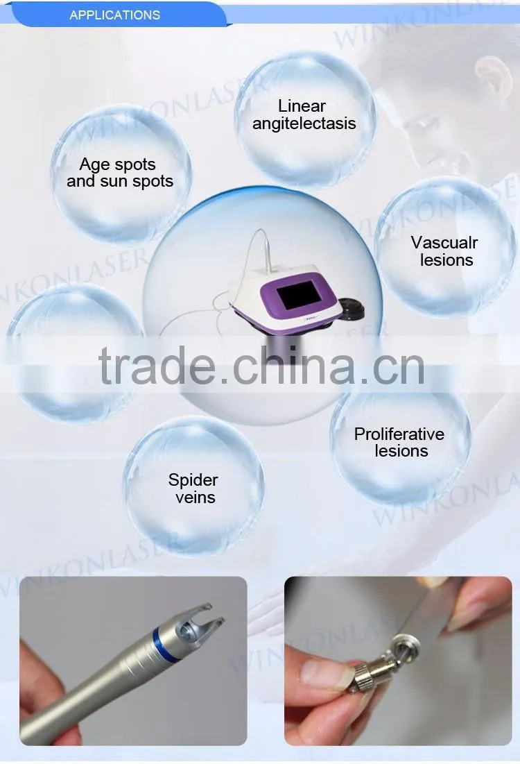 2016 professional portable device 980nm spider vein skin tag removal machine vascular remover