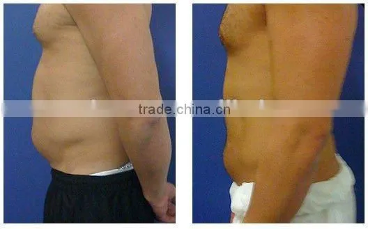 health & beauty weight loss slimming equipment -F017