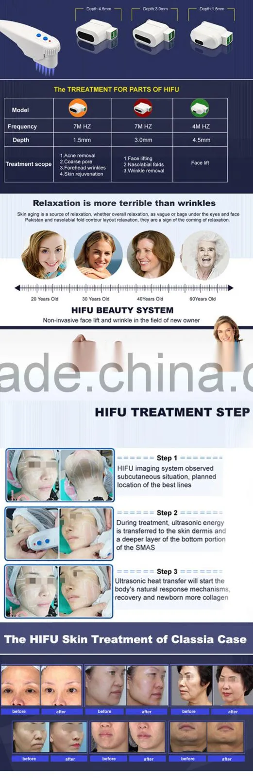 WF-32 Hifu high intensity focused ultrasound