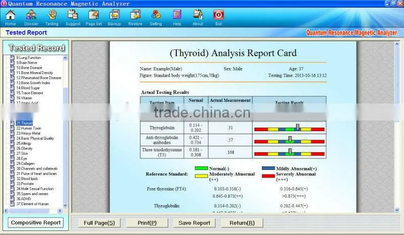 China Supplier 14 inches Display Quantum Magnetic Body Analyzer