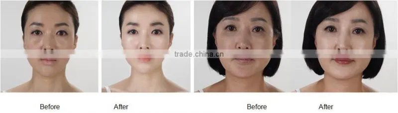 Rejuvera Instant Whitening Cream with Goat's milk gold capsule (Korea)