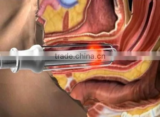 40w Fractional Co2 Laser Surgical Products vaginal applicator