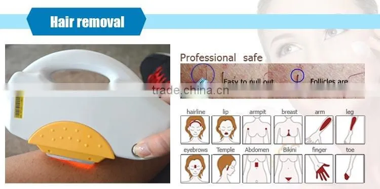 2016 new elight ipl+rf beauty equipment