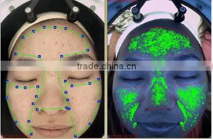 2016 Magic mirror skin analysis device skin analyzer high pixel