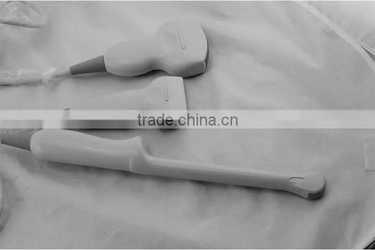 cheap prices of medical ultrasound machine for pregnancy