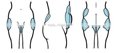 vacuum breast machine CE