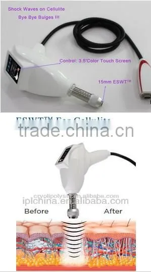 ESWT Shape(shock wave therapy equipment) transducer rf machine