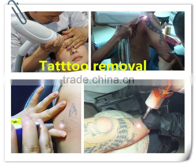 Portable Q switch nd yag Laser tattoo removal machine