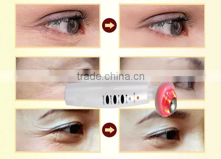 2017 Eye Wrinkle Remover Micro eyes Vibration Machine (charging)