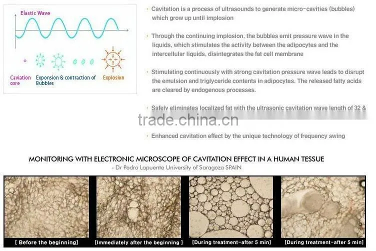 Home Use Cavitation Tighten Pores Beauty Machine (ostarbeauty )