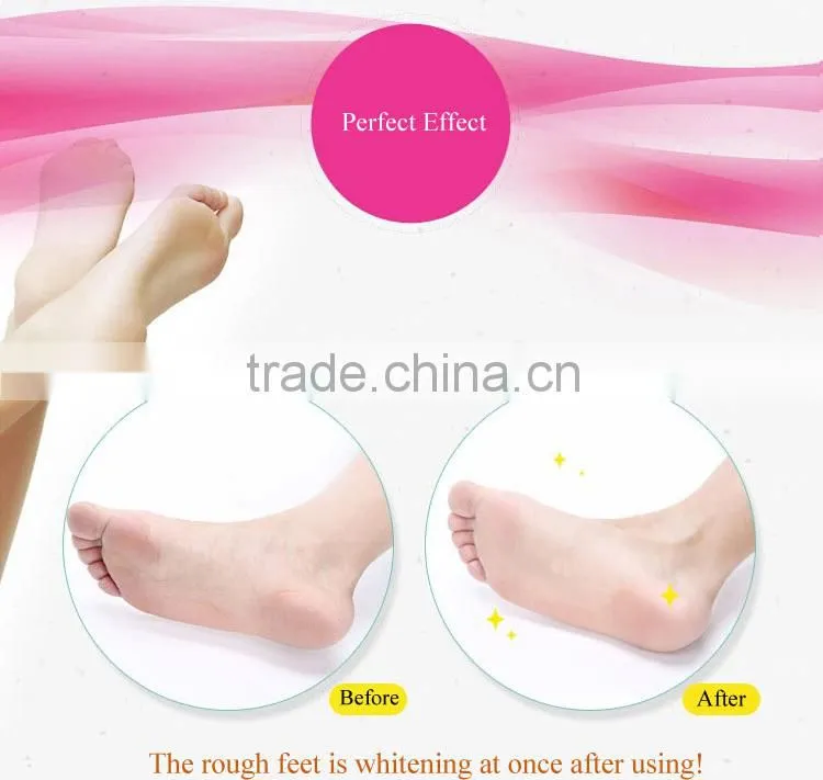 New Hot Callus Remover