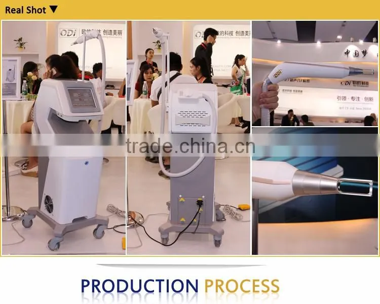2016 professional salon use q switch nd yag laser tattoo removal system