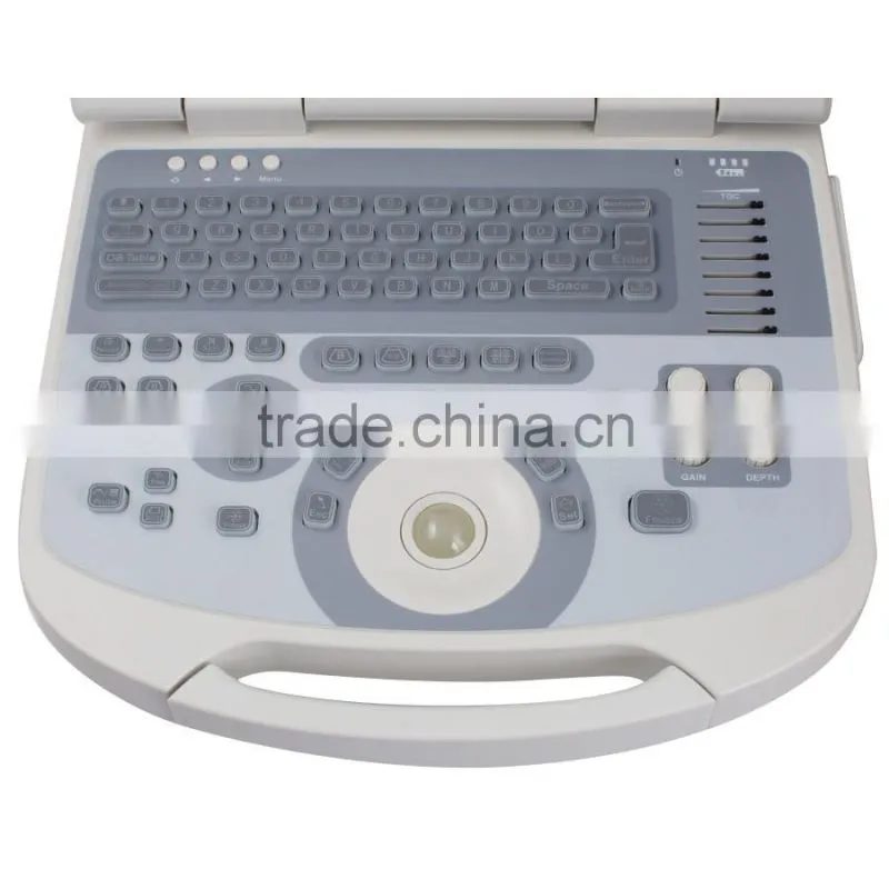10 inch portable ultrasound scanner USG machine with 3.5Mhz convex probe for OB/GYN urology etc