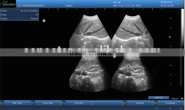 Sonostar good quality handheld portable vet ultrasound scanner pig veterinary ultrasound V10(SS-10V )
