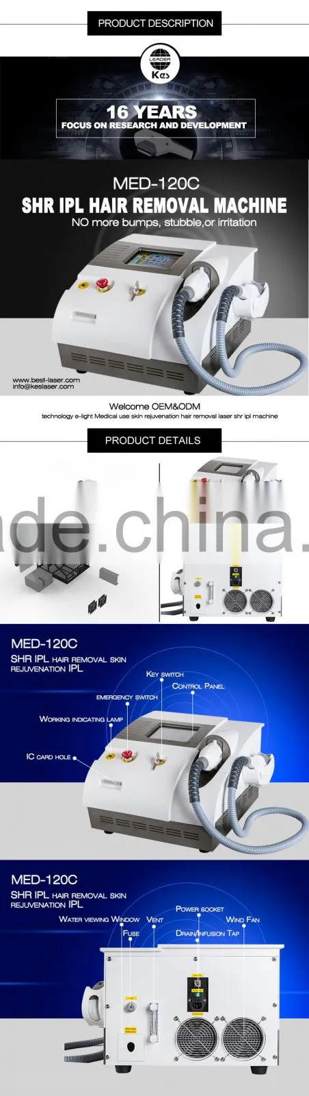 KES shr hair removal for body hair removal machine