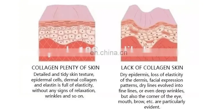 Mini RF Beauty Equipment That repair skin/ regenerates Skin/ Anti-aging