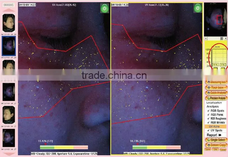 whole face testing skin analyzer magic mirror