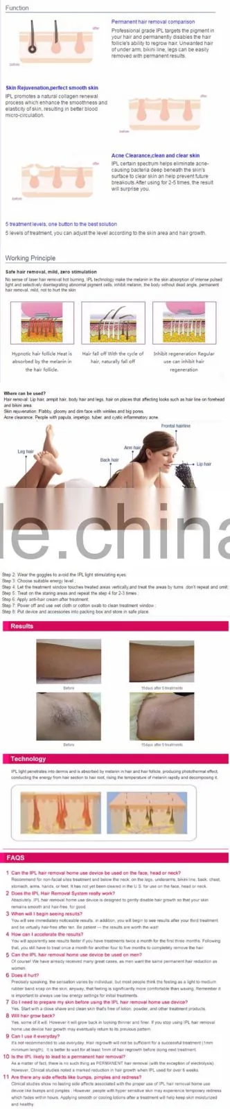 2016 new product IPL hair removal machine unwanted facial hair removal electrolysis permanent hair removal