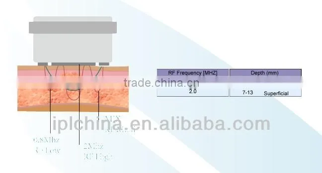 2014 Best Skin Tightening Pemf Therapy Device-PEMF Shape 2