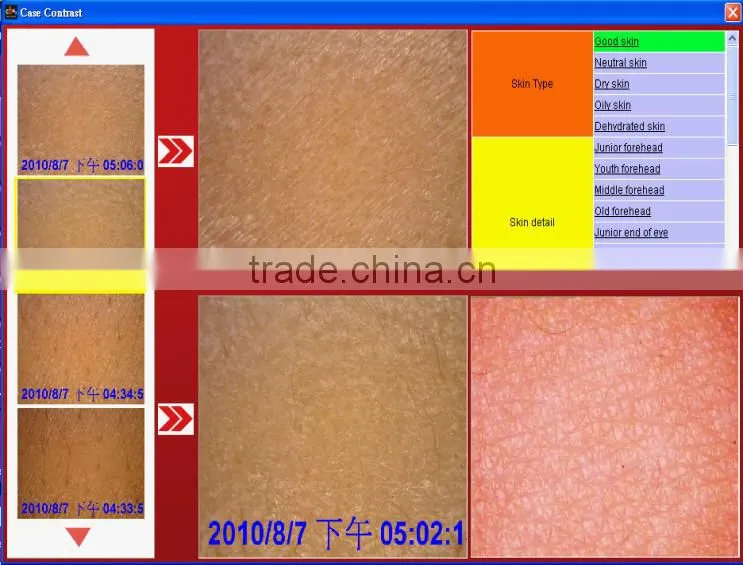 All in one Skin Analyzer System for Skincare; Skin Problems Test